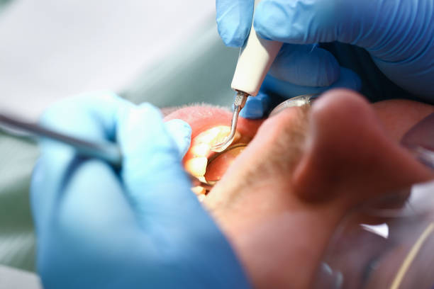 Best Emergency Wisdom Teeth Removal in Pharr, TX