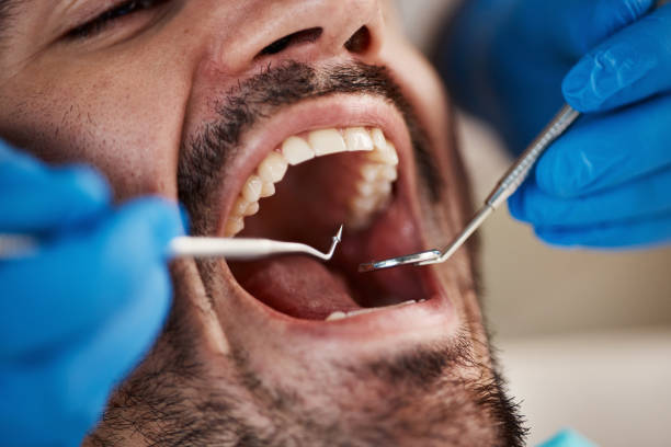 Best After-Hours Emergency Dentist in Pharr, TX